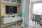 Apartamento com 3 dormitórios à venda, 81 m² por R$ 789.000,00 - Chora Menino - São Paulo/SP